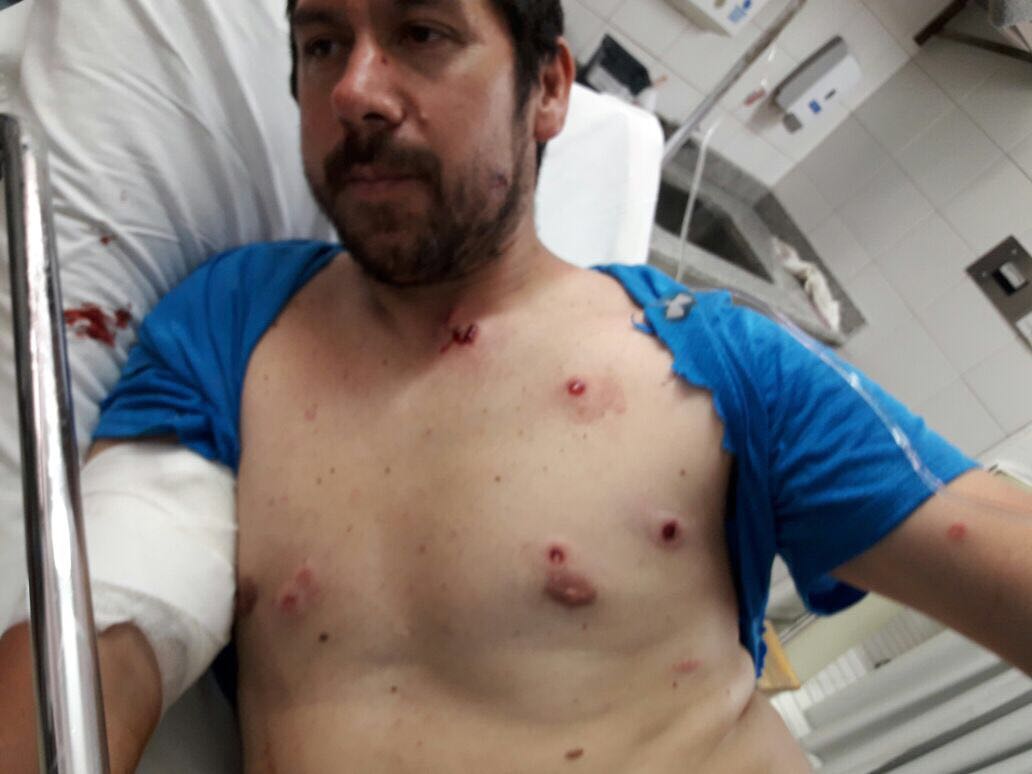 Heridos neuquen 1.jpg